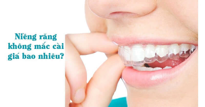 niềng răng không mắc cài invisalign