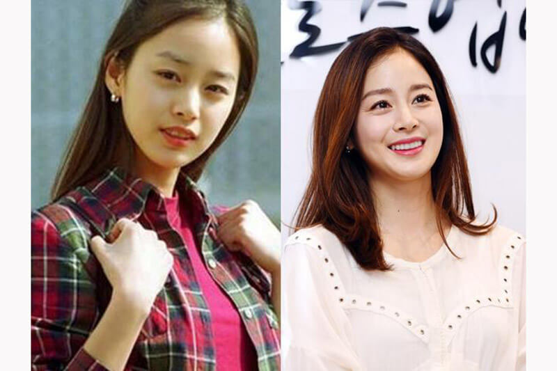 sao Hàn niềng răng