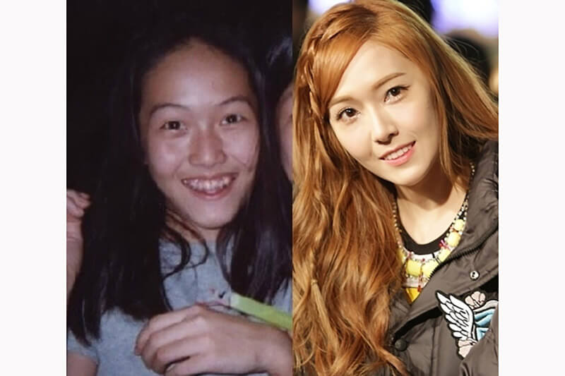 sao Hàn niềng răng