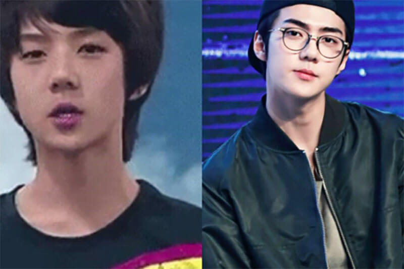 sao Hàn niềng răng