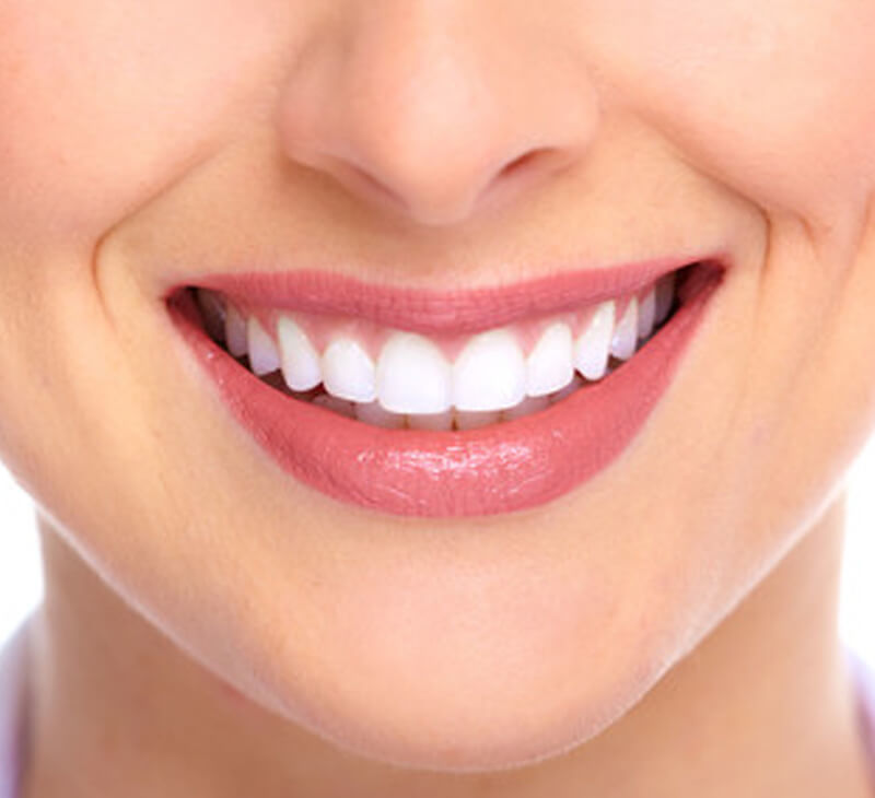 ăn gì sau khi tẩy trắng răng