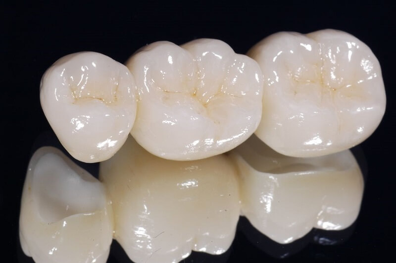 Bọc răng sứ bao nhiêu tiền