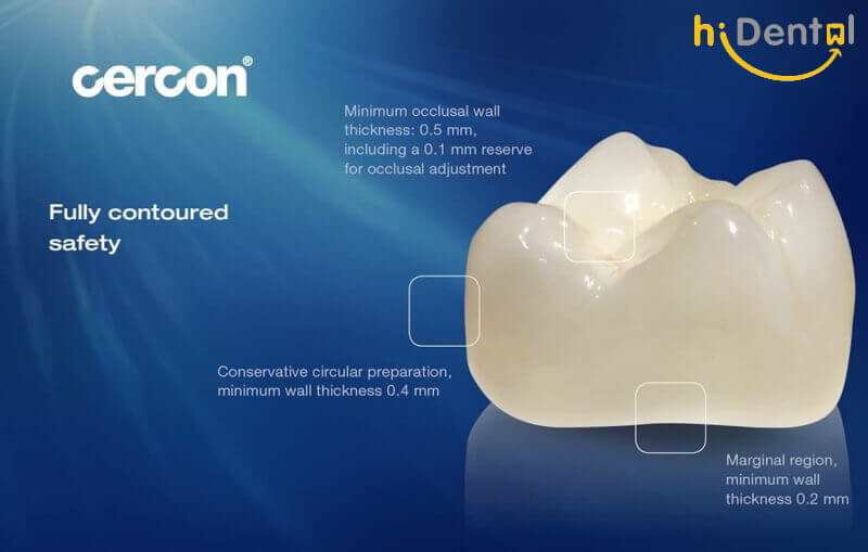 Bọc răng sứ cao cấp