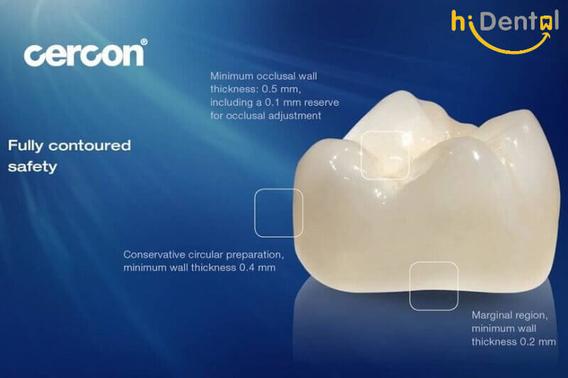 Bọc răng sứ Cercon