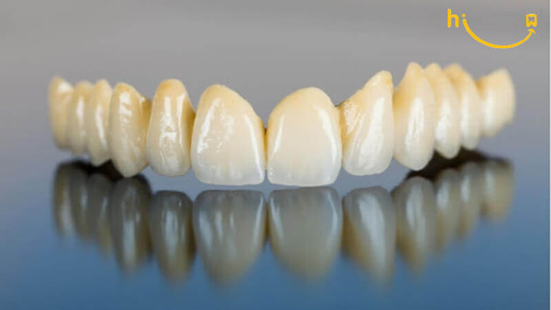 Bọc răng sứ Cercon