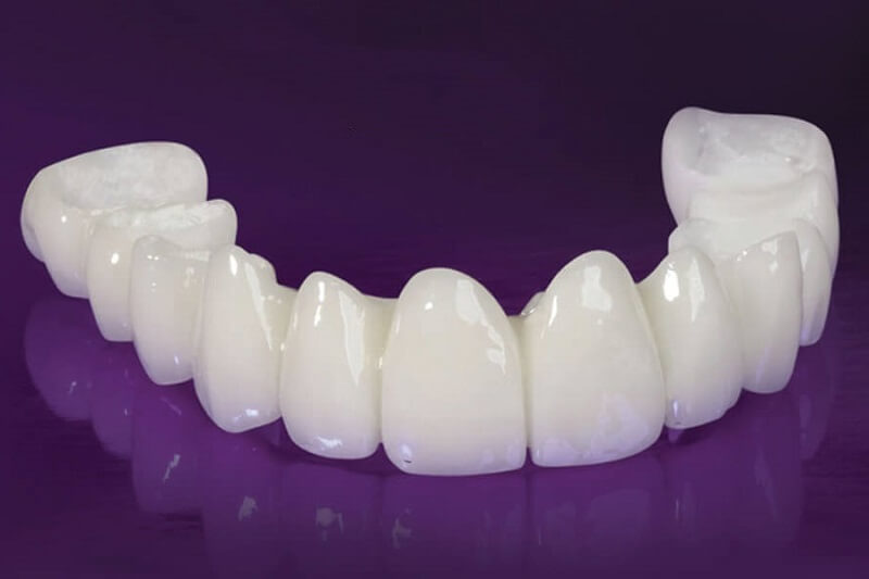 Bọc răng sứ có bền không