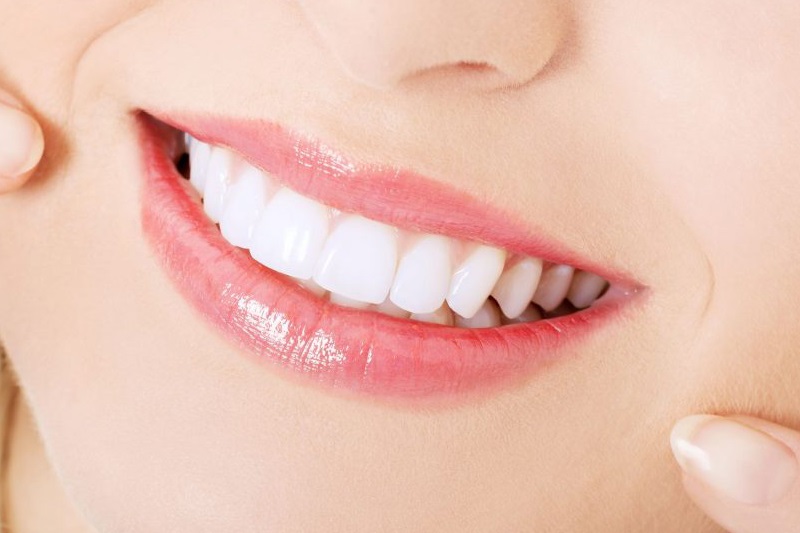 Bọc răng sứ titan