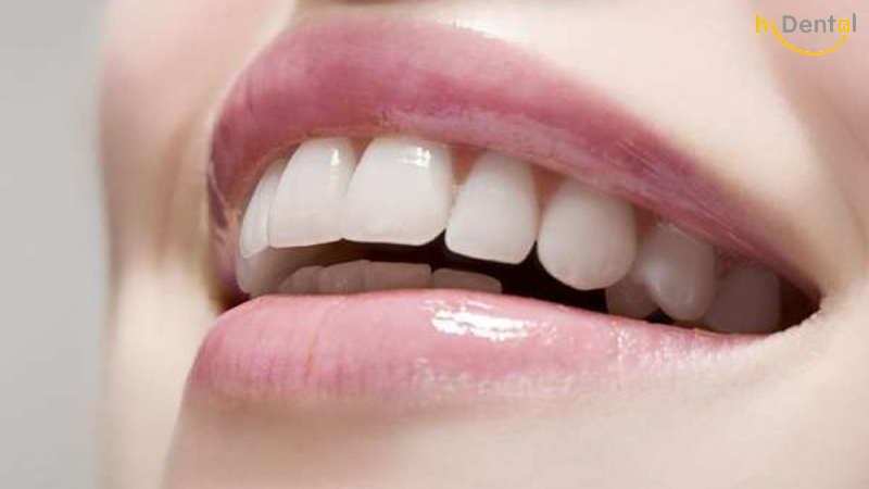 Gói khám doanh nghiệp-Nha khoa hiDental