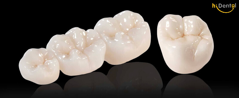 Bọc răng sứ Zirconia