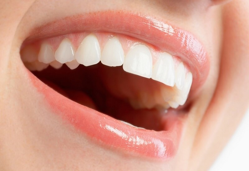 bút tẩy trắng răng