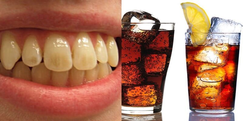 cách giữ răng trắng sau khi tẩy