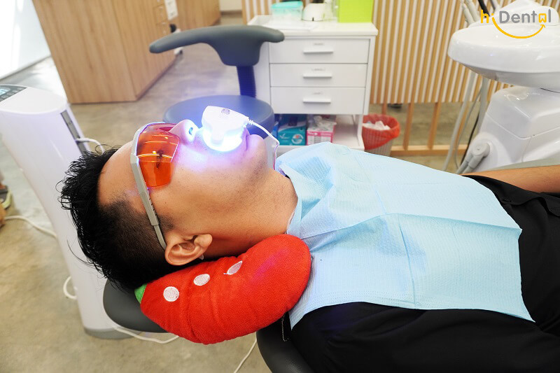 Dịch vụ tẩy trắng răng