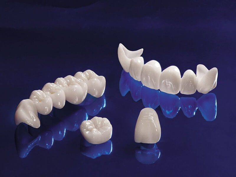 nên bọc răng sứ loại nào