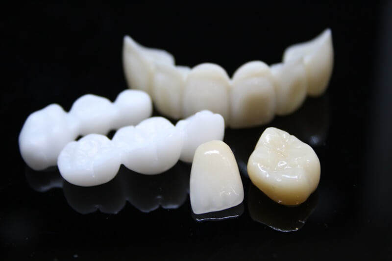 nên bọc răng sứ loại nào