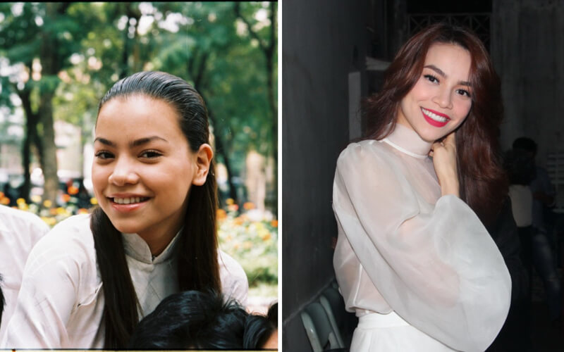 niềng răng giúp mặt thon gọn