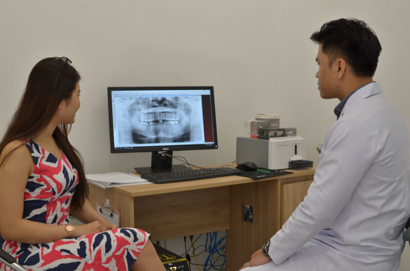 niềng răng hàm dưới