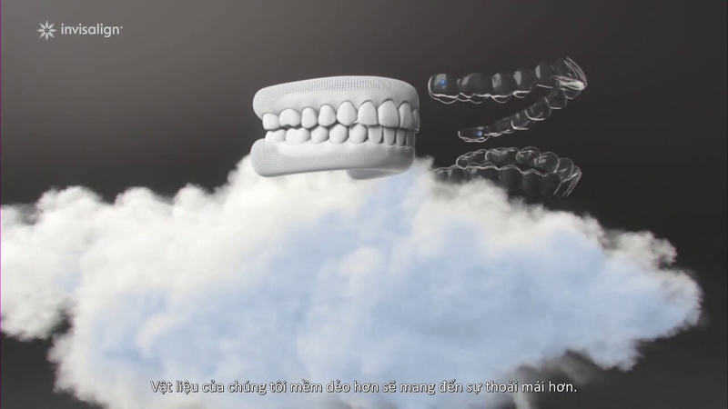 Niềng răng trong suốt