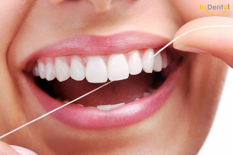 Tẩy trắng răng được bao lâu