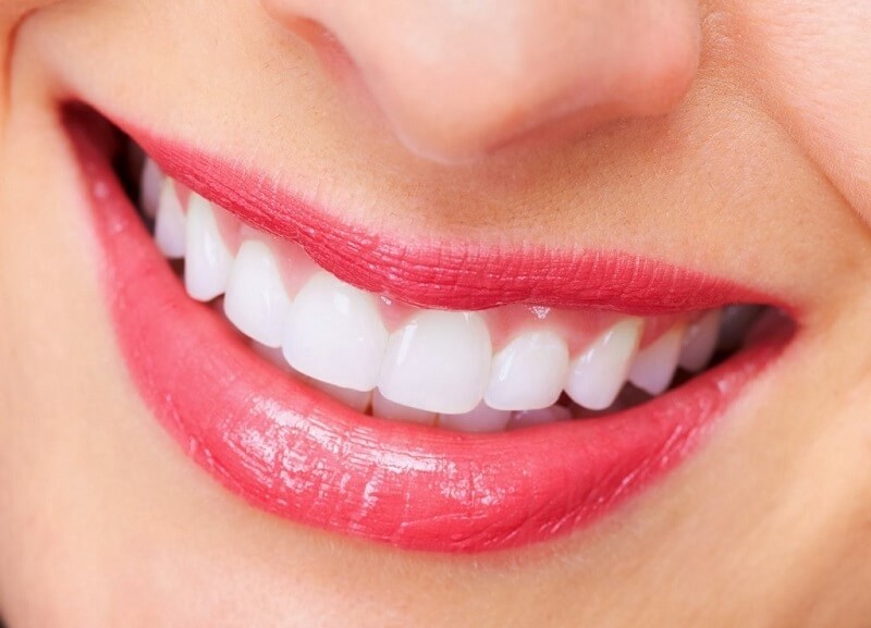 tẩy trắng răng bằng chanh