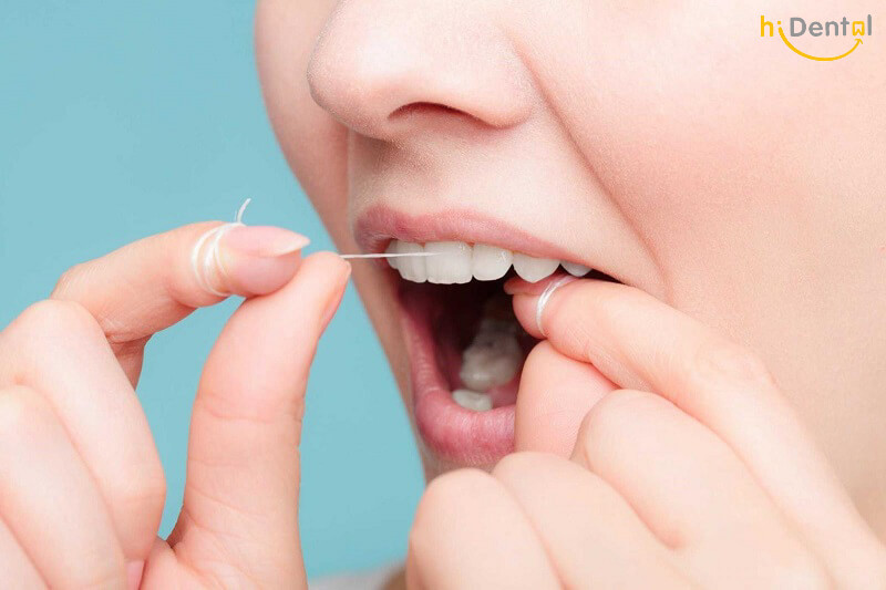 tẩy trắng răng có được uống bia không