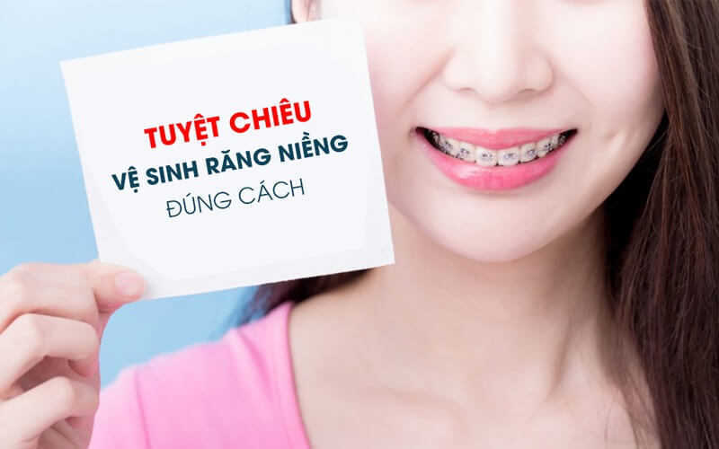 niềng răng tháo lắp