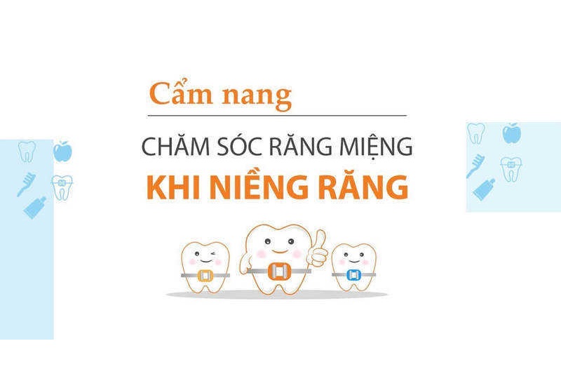 niềng răng tháo lắp