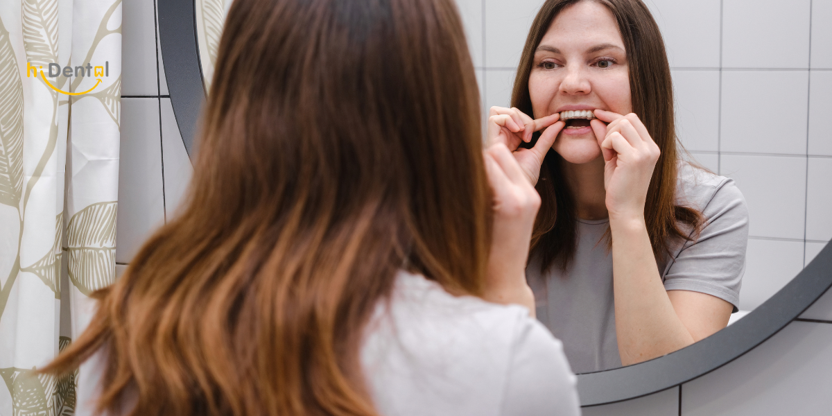 Niềng Răng Invisalign Là Gì