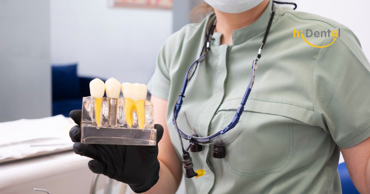 Trồng Răng Uy Tín HCM