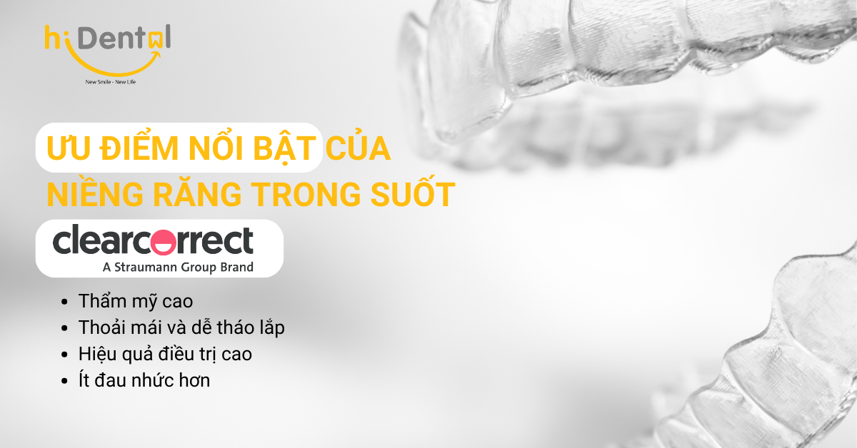 Quy Trình Niềng Răng Trong Suốt Clearcorrect
