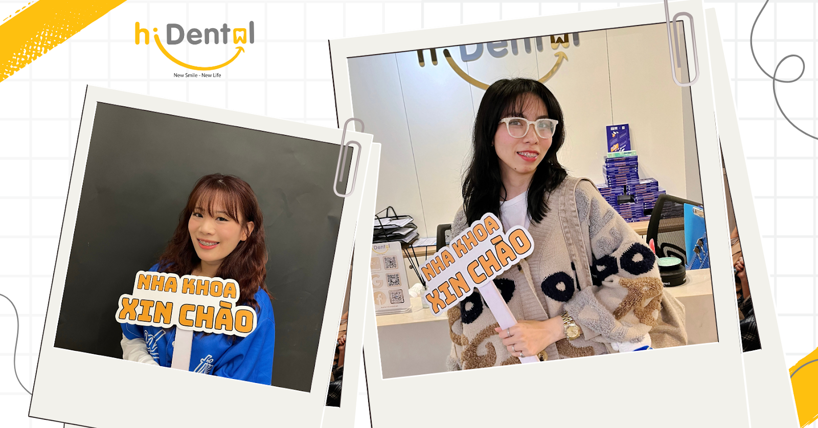 phương pháp niềng răng