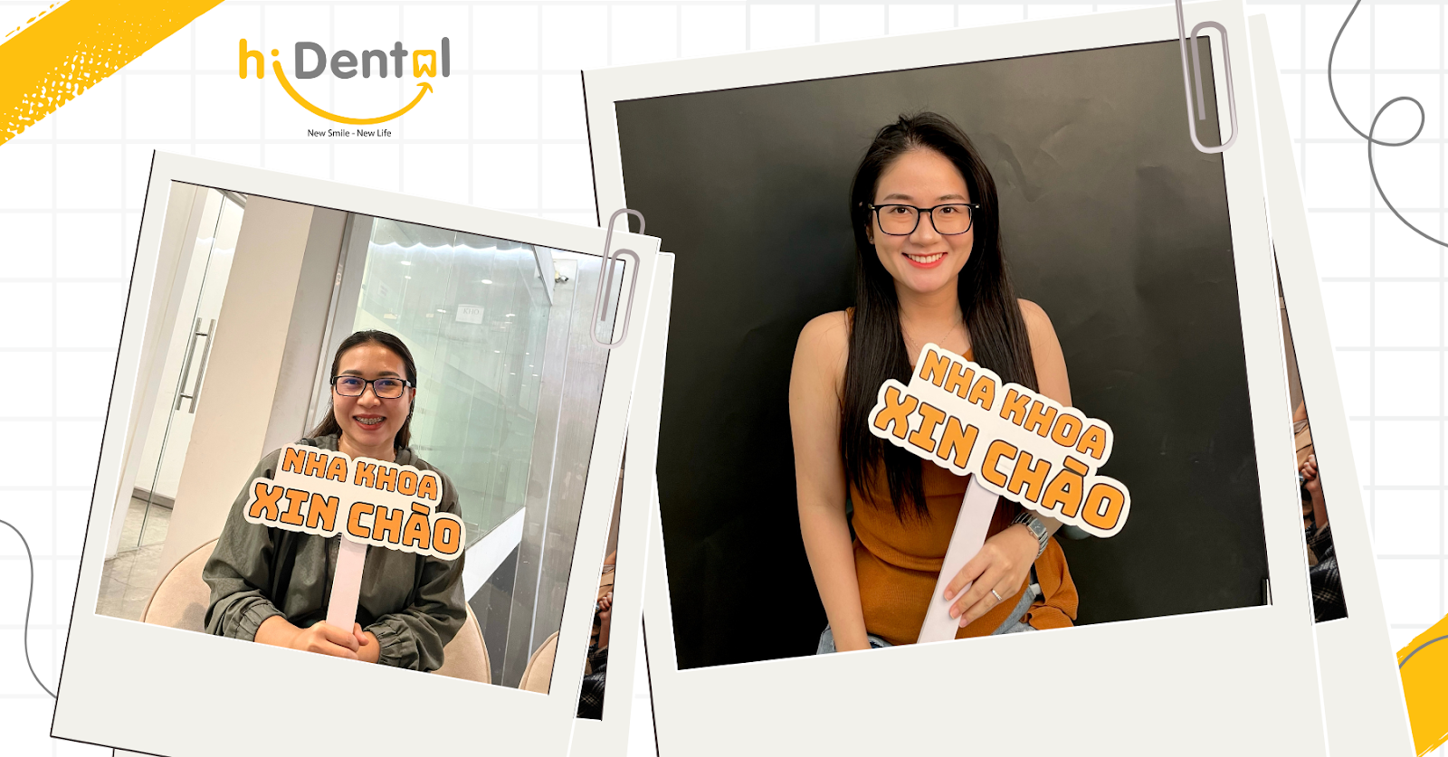 phương pháp niềng răng