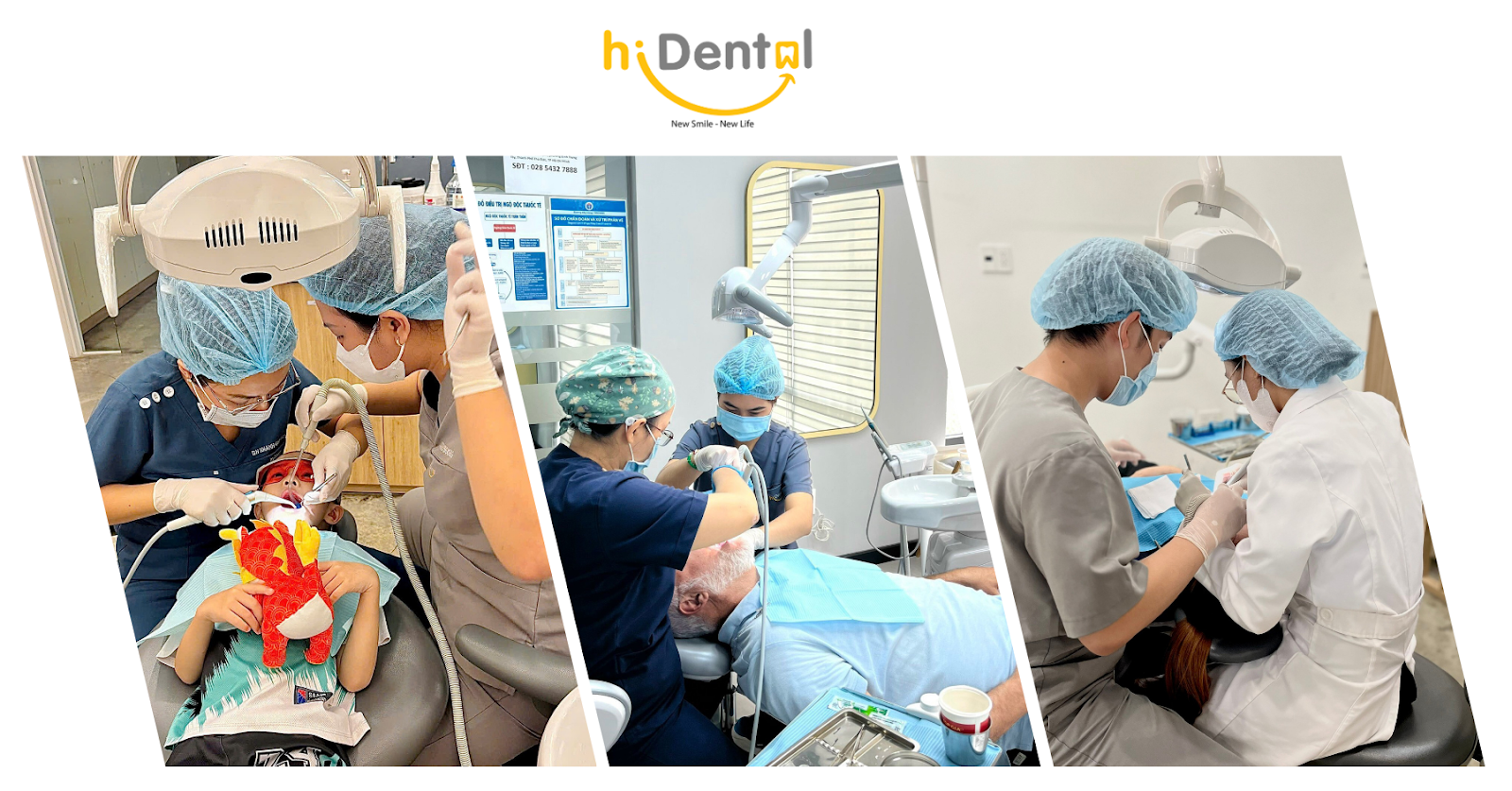 Giá Niềng Răng Mắc Cài