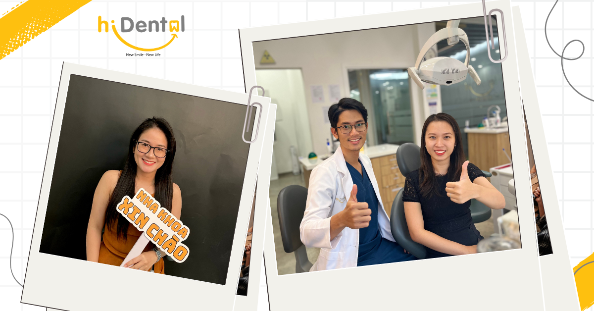 Giá bọc răng sứ là bao nhiêu