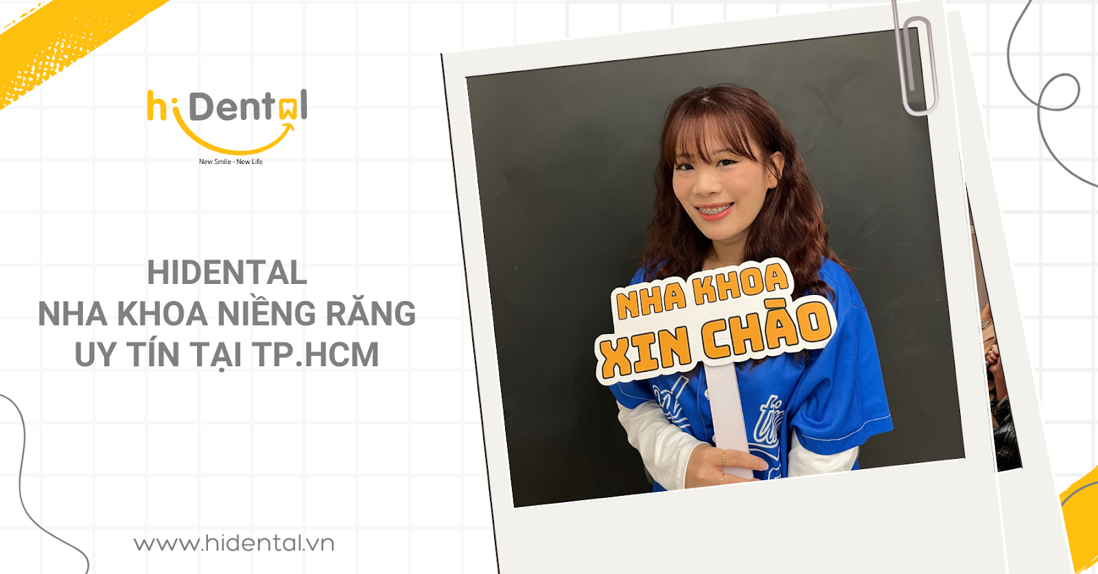 Cơ Sở Niềng Răng Uy Tín