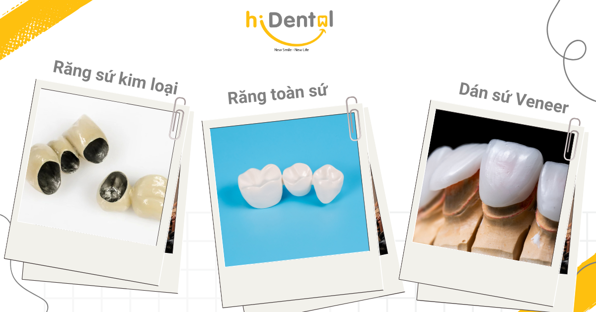 Nha Khoa Răng Sứ Uy Tín