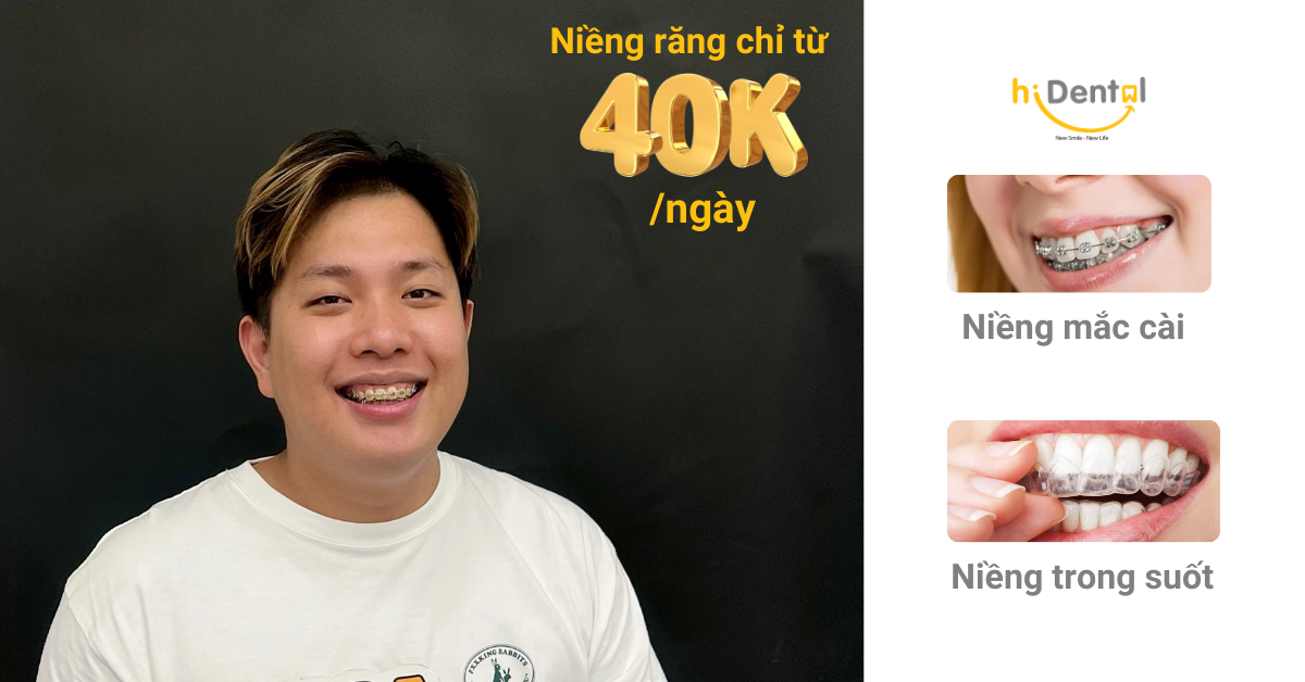 Nha Khoa Chuyên Niềng Răng