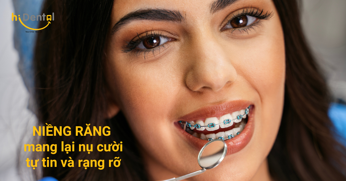 Nha Khoa Chuyên Niềng Răng