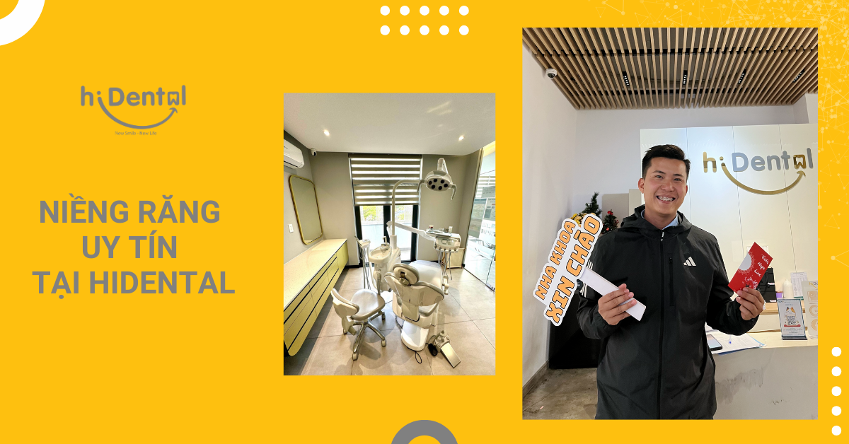 Niềng Răng Uy Tín