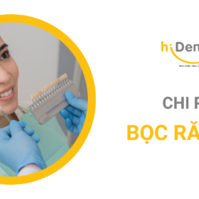 Chi phí bọc răng sứ là câu hỏi nhiều khách hàng quan tâm