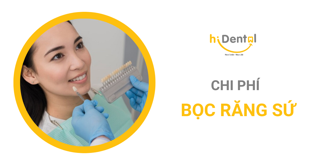 Chi phí bọc răng sứ là câu hỏi nhiều khách hàng quan tâm