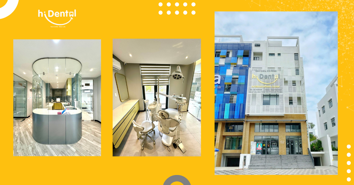 hiDental có quy trình niềng răng chặt chẽ, chu đáo