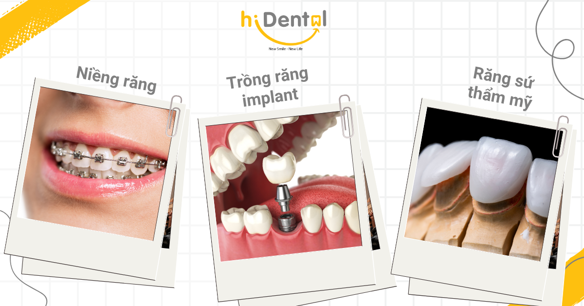 hiDental có nhiều dịch vụ toàn diện và chuyên sâu
