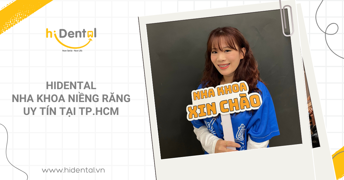 Quy trình niềng răng tại hiDental
